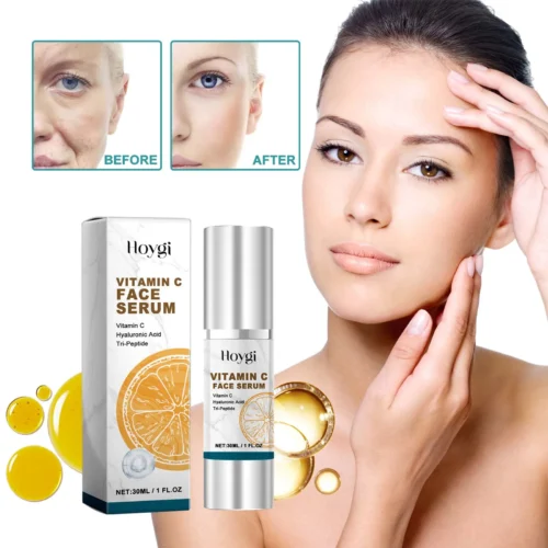 EELHOE Melanin Correcting Serum Fade Dark Spots Anti Freckle Melasma Remover Lightening Pigment Blemish Vitamin C Face Essence