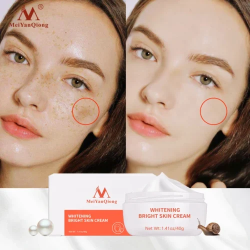 Moisturiser Face Whitening Freckle Cream Remove Acne Spots Melanin Dark Spots Face Lift Firming Face Skin Care Bright Skin Cream